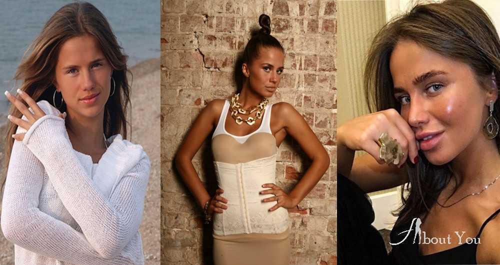 Алекса: пластика певицы, результаты для носа, губ до и после
