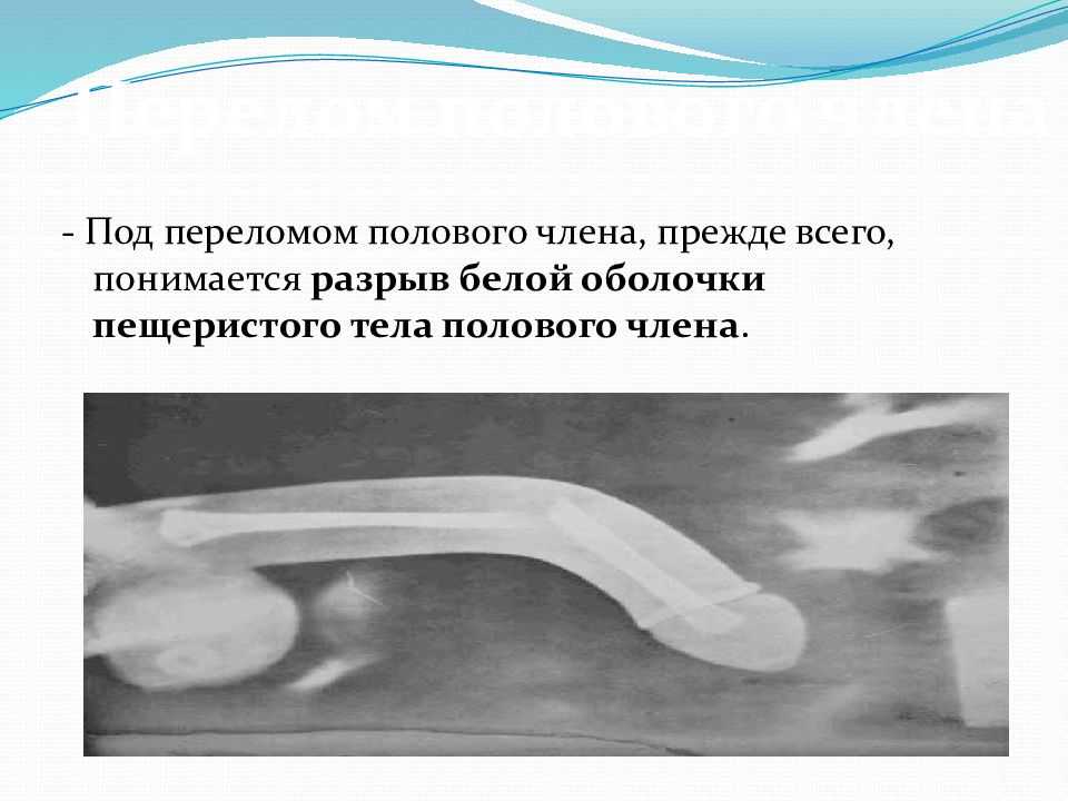 Что такое клитор и где он находится?