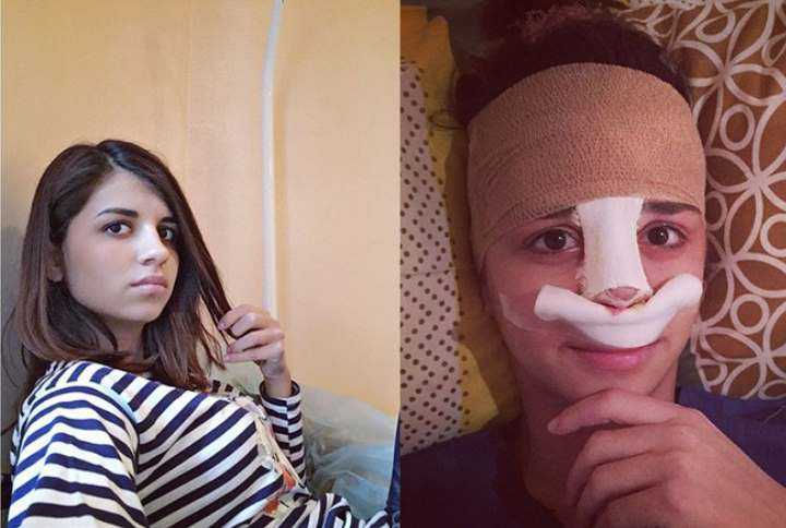  алиана устиненко ( гобозова) до и после пластики +фото и видео
