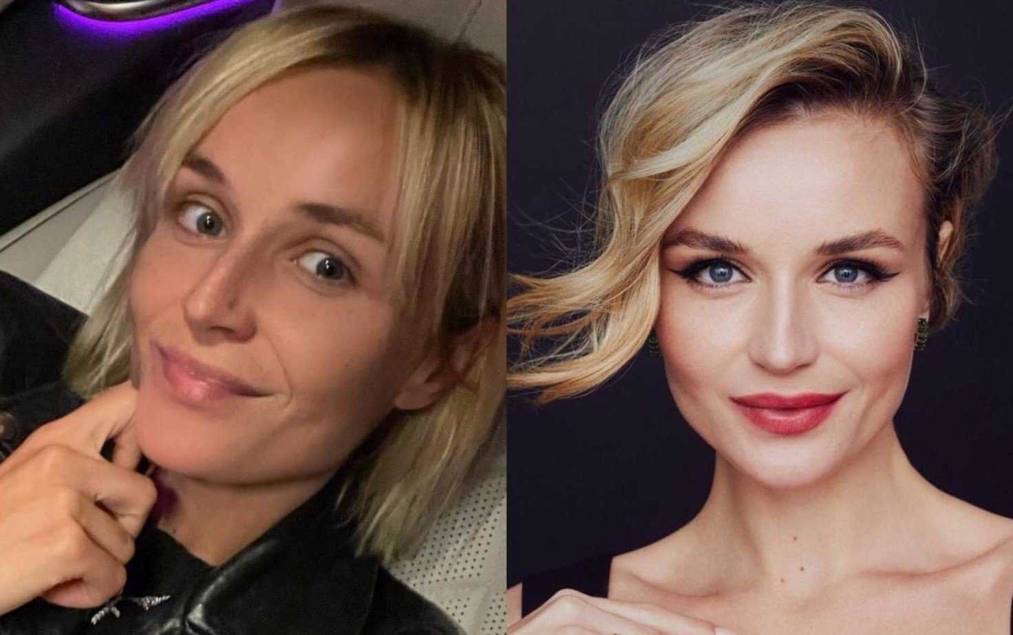 Полина гагарина косоглазие – полина гагарина до и после пластики: как певице удалось похудеть на 40 килограмм и что она сделала со своим лицом —  вместе — сайт общественного движения