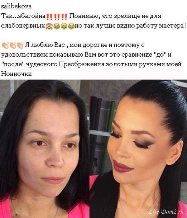 Прошла неделя с тех пор, как звезда Дома-2 ошарашила подписчиков снимком перебинтованного лица без малейших комментариев