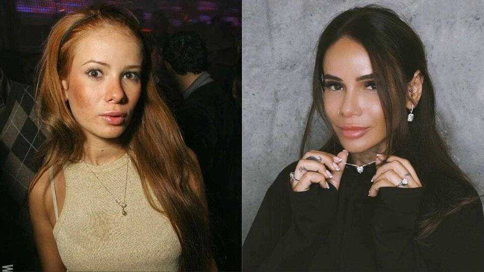 «доктор, перешейте меня!»: 10 звёзд, которые сначала наделают операций, а потом все исправляют