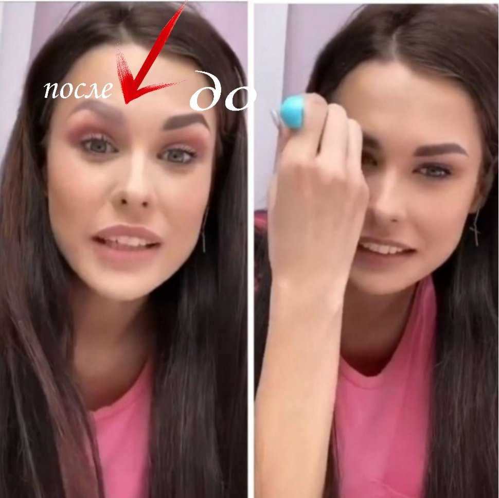 Пинчук до и после пластики фото и биография — видео. кто такая ирина пинчук.