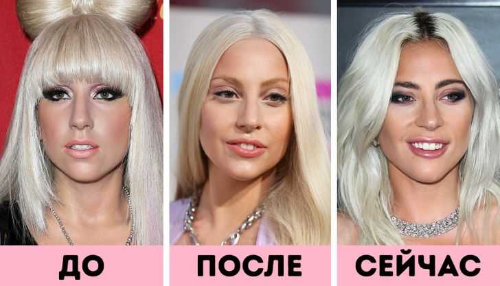 Леди гага до и после пластики