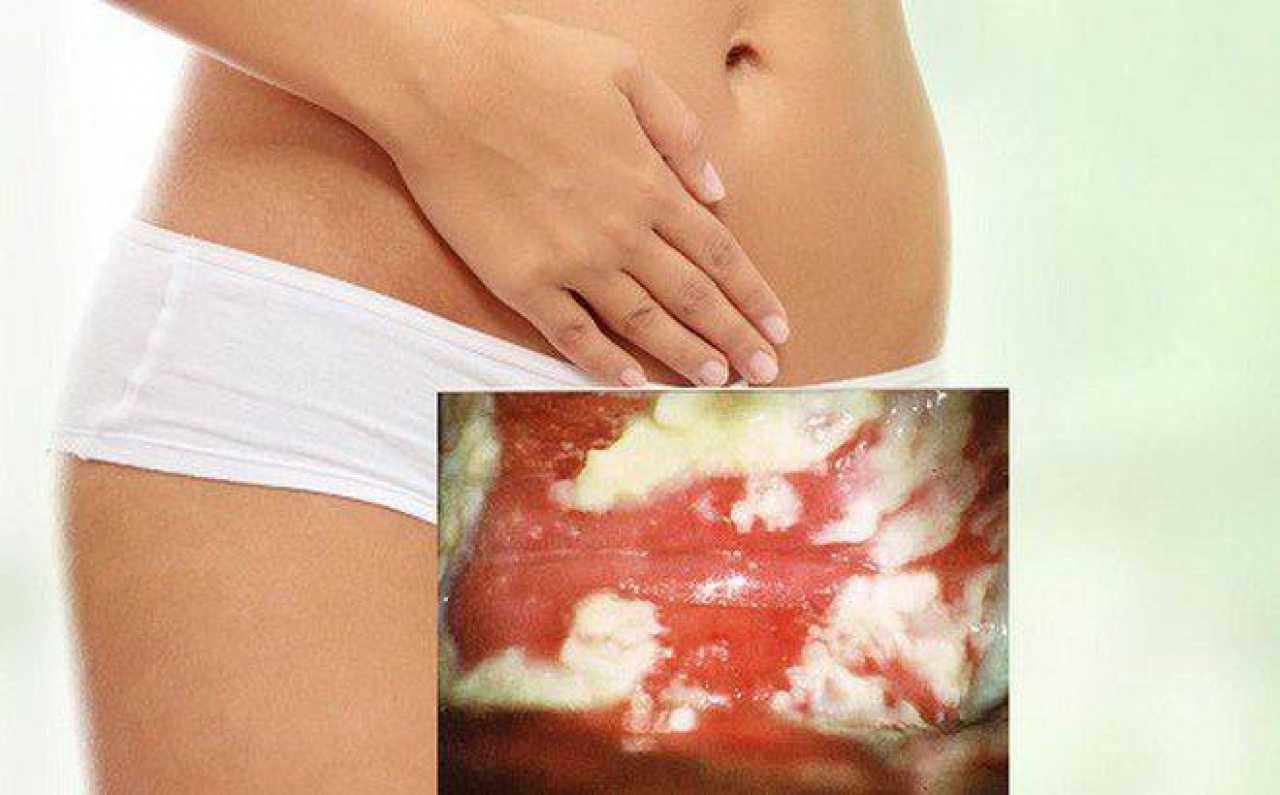 Period-shaming: почему женщины стесняются «красных дней календаря» - умная