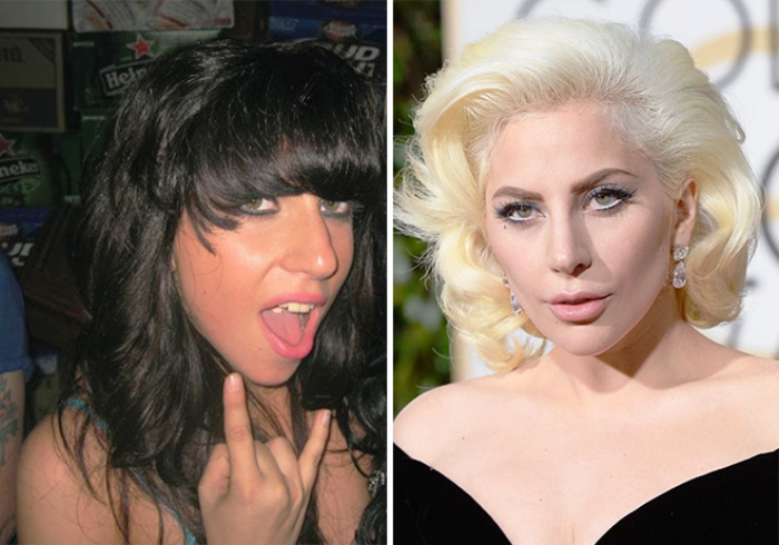 Lady gaga plastic surgery - a complete history | new idea magazine