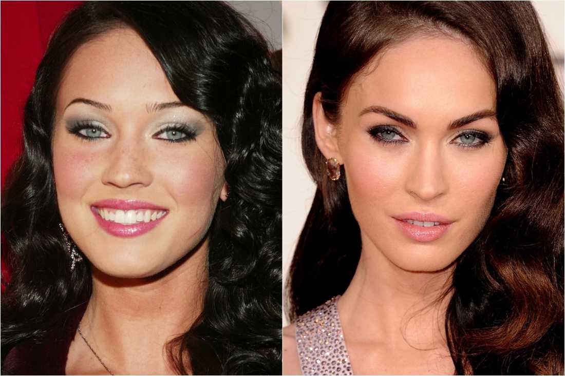 10 знаменитостей с самыми дорогими грудными имплантатами в истории - ✪ most beauty ✪